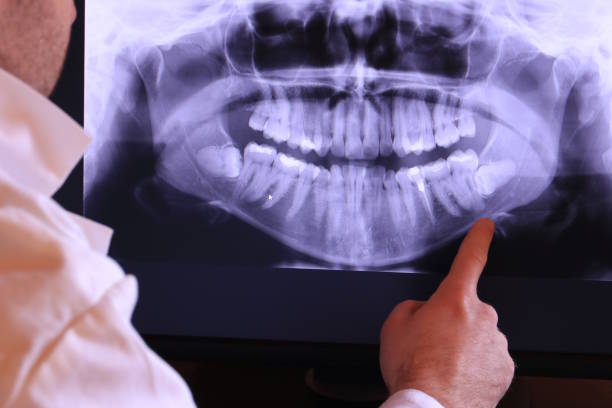 Best Pediatric Emergency Dentist in Lemoore, CA